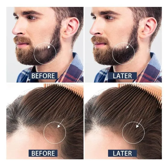 images de la barbe d'un homme et d'un cuir chevelu de femme avant et apres utilisation