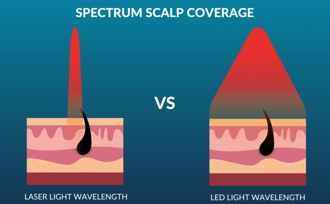 image comprative d'un faisceau lumineux LED et LASER