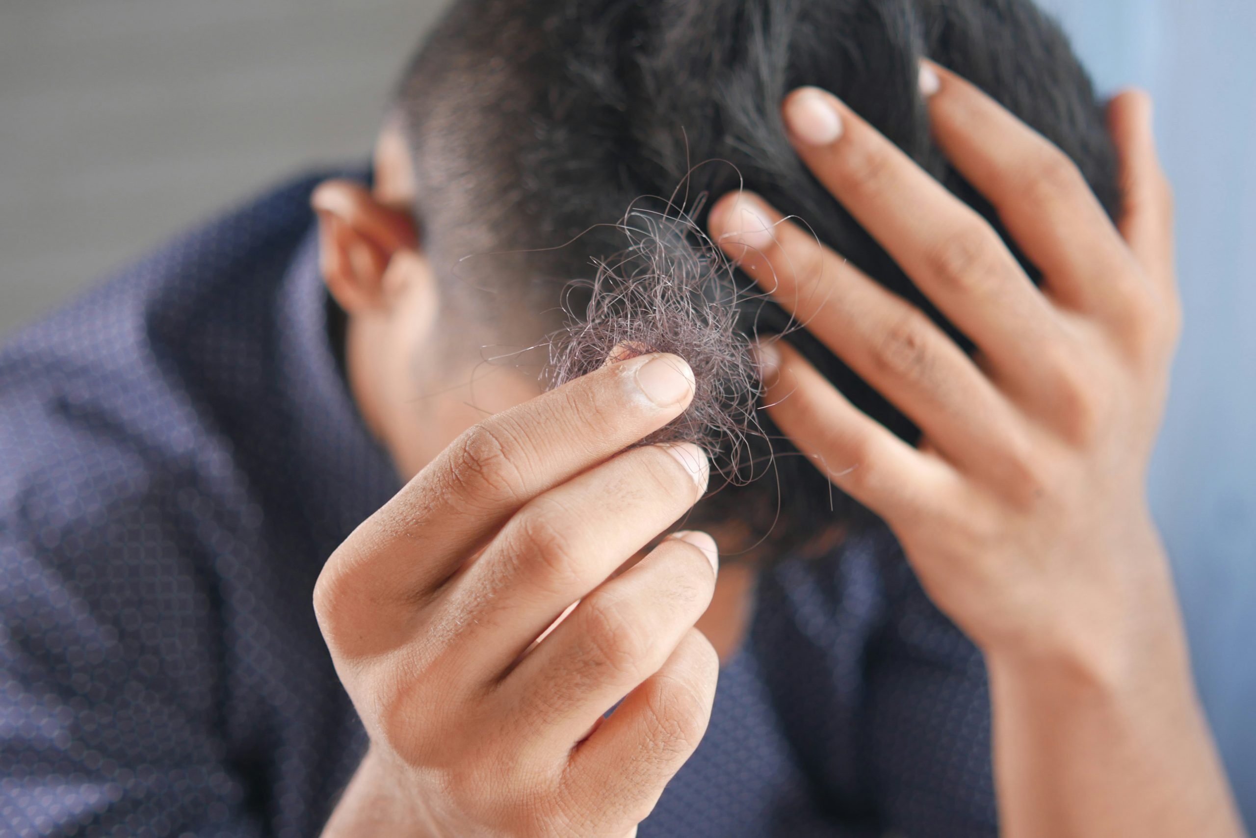 towfiqu-barbhuiya-FGqEuM0wuKk-unsplash homme baissant la tête et tenant une poignée de cheveux dans les mains